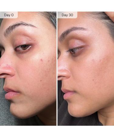 Qure Micro Infusion System for Face & Neck - Facial Moisturizing Essence Hydrating Serum for All Skin Types Refreshed Skin - 3-Month Supply 3 Month - Buy Online on GoSupps.com