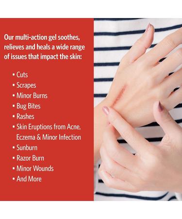 Sovereign Silver First Aid Gel 2 fl oz - Natural Healing with Colloidal Silver - Buy Online on GoSupps.com