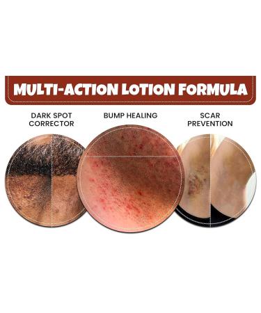 BUMP Terminator Fast Acting Anti-Razor Bumps & Ingrown Hair Treatment - Alcohol-Based & Water-Free Lotion for Face Neck Bikini Legs & Back - Unisex - 5.4 fl oz - Buy Online on GoSupps.com