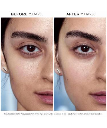 Lanc me Nightime Skincare Routine Duo - Cr me Radiance Cream-to-Foam Face Cleanser 4.2 Fl Oz & G nifique Radiance Boosting Anti-Aging Face Serum 0.67 Fl Oz - Buy Online on GoSupps.com