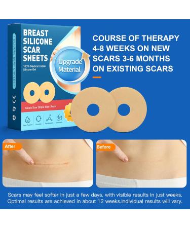 6 Pack Silicone Scar Sheets for Breast - Effective Scar Removal & Post-Surgery Treatment - Buy Online on GoSupps.com