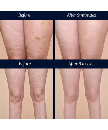 ADONIA LEGTONE Organic Natural Cellulite Cream - Anti-Cellulite Treatment for Soothing, Relaxing, Tightening, and Firming Skin - Buy Online on GoSupps.com