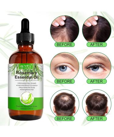 Organic Rosemary Oil for Hair Growth and Skin Care - 120ml Pure Essential Oil for Hair Loss Treatment - Buy Online on GoSupps.com
