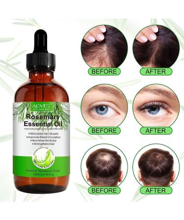 Organic Rosemary Oil 4.04 oz | Hair Growth & Skin Care | Scalp Treatment for Hair Loss | Pure & Upgraded - Buy Online on GoSupps.com