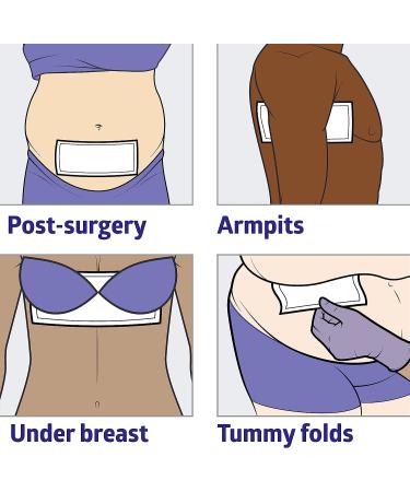 Medline Skinfold Dry Sheet 6 x 14 (10 Count) - Soft, Non-Chafing, Skin Moisture Management - Buy Online on GoSupps.com