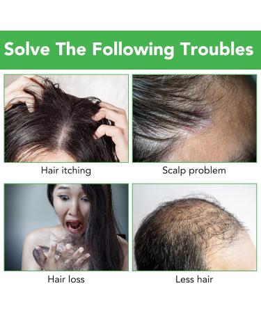 Rosemary Essential Oil for Hair Growth +Rosemary Shampoo for Hair - 100% Pure Organic Nourishes Scalp Stimulates Hair Growth - Buy Online on GoSupps.com