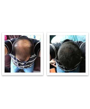 Caboki Plant-Based Hair Concealer - Covers Bald Spot & Thinning Hair - Black (16G) - Buy Online on GoSupps.com