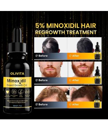 HJZWTS 5% Minoxidil Beard & Hair Growth Serum Kit for Men - Biotin & Caffeine - Thicker Fuller Growth | Unscented | 1.7oz - Buy Online on GoSupps.com