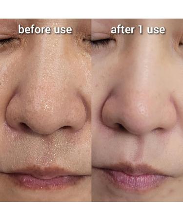 Hydrogen Dual Skin Changer Set | Hydrating Anti-Aging K-Beauty Therapy | International Shipping - Buy Online on GoSupps.com