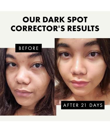 Brightening Dark Spot Corrector for Face and Body - Green Tea Extract, Vitamin C & E - Vegan & Cruelty-Free - 1 oz - Buy Online on GoSupps.com