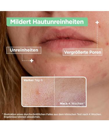  Mixa Mixa Anti-Impurity Serum for Sensitive and Acne Prone Skin with Salicylic Acid Squalane and Niacinamide Suitable for Face and Neck Hypoallergenic 30ml - Buy Online on GoSupps.com