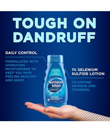 Selsun Blue Normal-Oily Hair Anti-Dandruff Shampoo 300mL Helps Control Dandruff Itching and Flaking 1% Selenium Sulfide Formula - Buy Online on GoSupps.com