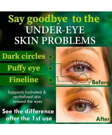 Puffy Eyes & Dark Circles Under Eye Mask with Collagen & Green Tea - Anti-Aging Treatment for Wrinkles, Puffiness & Bags - Buy Online on GoSupps.com