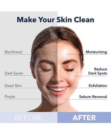 PURDERM Deep Purifying Pink O2 Bubble Mask 0.88oz x 5ea - Korean Beauty Cleanser with Peach Extract and Charcoal for Nourishing and Sebum Control - 5 Count - Buy Online on GoSupps.com