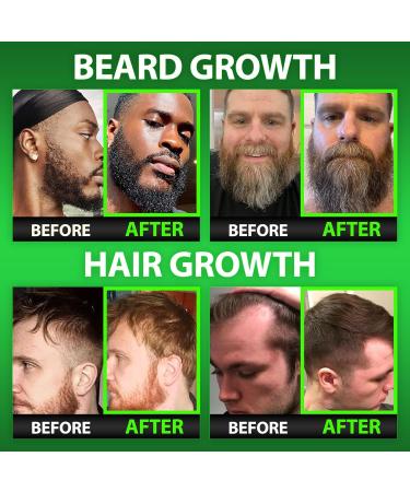 Beard Growth Kit w/Maximum Strength 14-in-1 Beard Growth Vitamins & Hair Vitamins Gummies + 6X Liquid Biotin with Collagen Peptides + 2X Biotin Mustache Wax & Balm for Men - Formulated in America - Buy Online on GoSupps.com