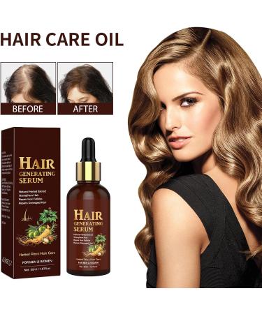 Rosemary Oil for Hair Hair Growth Oil Ginseng Hair Regrowth Serum Relieve Dry Damaged Hair to Target Hair Loss Hair Growth Oil for Hair Rapid Growth and Thickening Trengthen Hair Roots - Buy Online on GoSupps.com