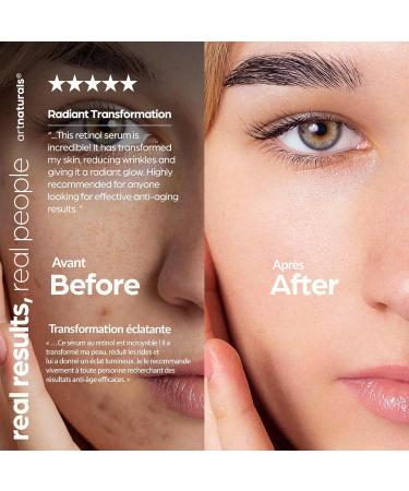ArtNaturals Retinol Serum for Face - with Vitamin C 2.5% Retinol Oil & Hyaluronic-Acid - Skin Clearing - Anti-Aging Anti-Wrinkle Eye Serum - Skin Repair Night Therapy (1 Fl Oz / 30ml) (ANGA-0127) - Buy Online on GoSupps.com