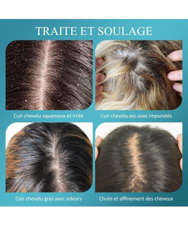 Gommage du Cuir Chevelu Biotine et Acide Salicylique Exfoliant Pour la Croissance Des Cheveux Cheveux Gras Tendance Pelliculaire et Cuir Chevelu Qui D mange Pr vention de la Chute Des Cheveux - Buy Online on GoSupps.com