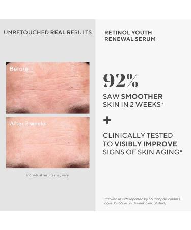 Murad Resurgence Retinol Youth Renewal Serum - Anti-Aging Serum for Lines and Wrinkles -Retinol Serum for Face and Neck - Youth Serum for Smoother Skin 30 ml - Buy Online on GoSupps.com