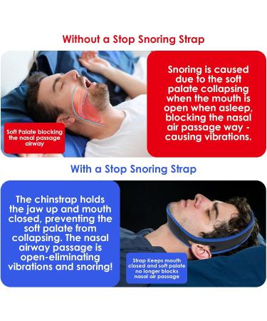 Adjustable Anti-Snoring Chin Strap Breathable Stopper for Men & Women - Buy Online on GoSupps.com