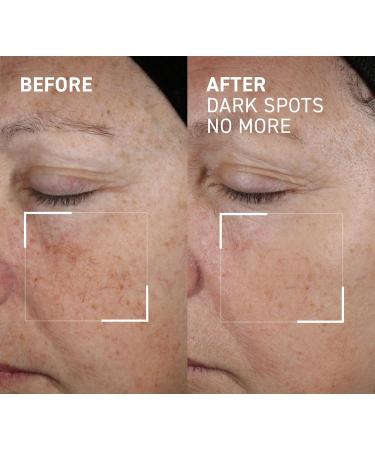 Dr. Brandt Bright This Way Dark Spots No More - Reduce Pigment Spots 0.5 fl oz | Shop Internationally - Buy Online on GoSupps.com