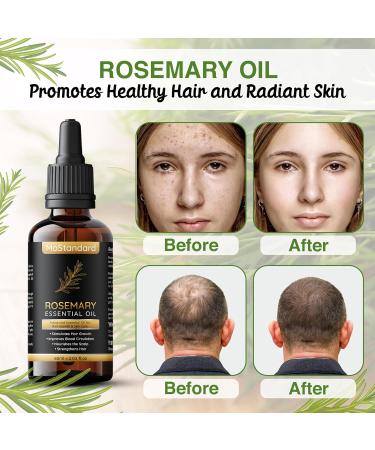 MoStandard Rosemary Essential Oil for Hair Loss, Growth, and Repair - 60ml | Fuller, Healthier Hair for Men and Women - Buy Online on GoSupps.com
