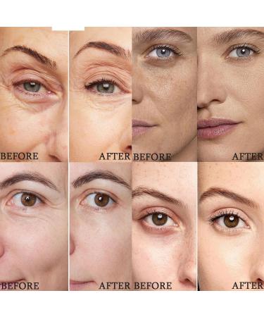 YECDET Noctive Eye Balm Subliskin Eye Cream Instantly Hydrate and Brighten Eyes Creams Reduces Dark Circles and Puffiness (2) - Buy Online on GoSupps.com