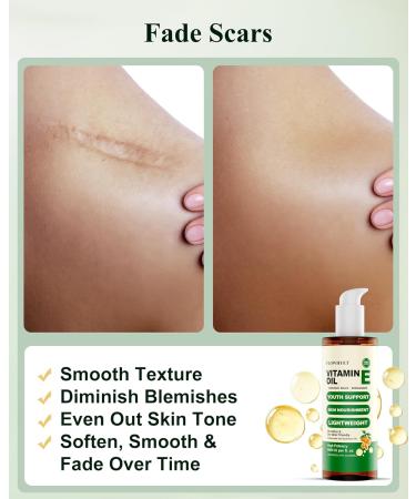 5 Floz Vitamin E Oil For Skin Scars Pure Organic Nail Oil vit e for Cuticle Face Body and Hair Nourish Dry Skin Maintain Youthful Antioxidant Fade Scars LIGHTWEIGHT - 150ml 5 Fl Oz (Pack of 1) - Buy Online on GoSupps.com