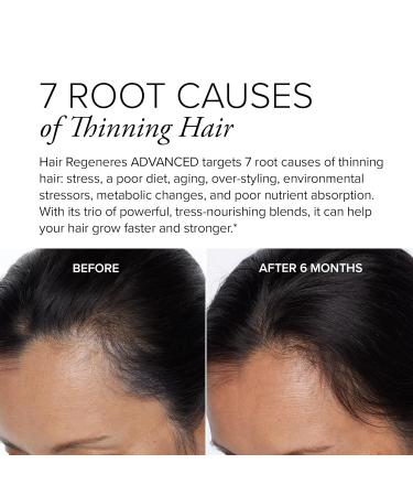 SeroVital Hair Regeneres Advanced - 90 Capsules | 30-Day Supply for Healthy Hair Growth - Shop Internationally - Buy Online on GoSupps.com