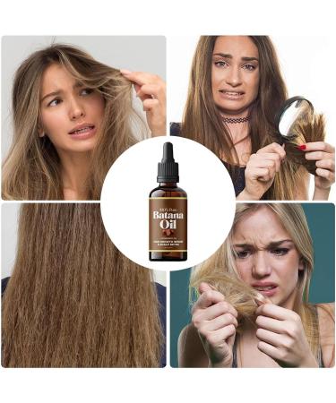 Batana Oil For Hair Growth Hair Regrowth Oil Nourishing Hair Thickening Essence Scalp Care Anti Hair Loss Batana Oil For Men & Women - Buy Online on GoSupps.com