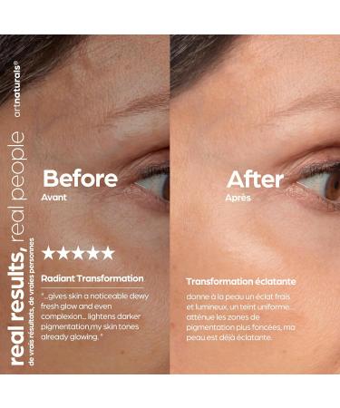 ArtNaturals Hyaluronic Acid Serum - Anti- Aging Facial Serum Natural Moisturizer w/Vitamin C Serum & Vitamin E - for Skin Care - Reduce Wrinkles & Dark Spots (1 Fl Oz (Pack of 1)) - Buy Online on GoSupps.com