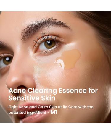 Spot Clear Essence 50ml by A.C. Promise x Avarelle | Gentle Acne Treatment for Sensitive Skin | Korean Skincare for Acne-Prone Skin - Buy Online on GoSupps.com