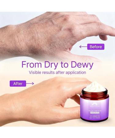 Iridescence Discourse Beef Tallow for Skin, Grass-Fed Tallow and Honey Balm, Nourishing Tallow Face Moisturizer Natural Beef Tallow for Dry, Sensitive, or Irritated Skin Unscented 4oz - Buy Online on GoSupps.com