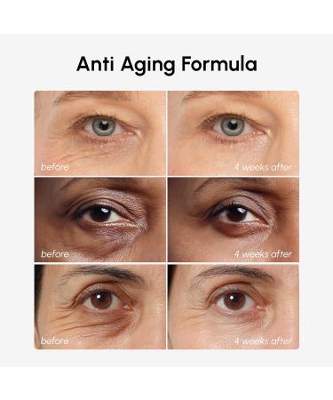 MAREE Under Eye Balm Stick with Retinol & Ceramide Complex Facial Moisturizer for Dark Circles & Wrinkles Under Eye Brightener Stick Anti-Wrinkle Hydrating Face Skincare 0.35 Ounce (Pack of 1) - Buy Online on GoSupps.com