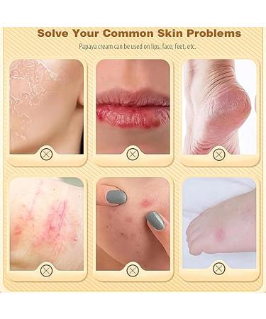  Nurvidis Natural Papaw Ointment Natural Cream to Smooth and Soothe Nourishing for Lips Repairing for Skin Lips Hands and Cuts (75g+25g) - Buy Online on GoSupps.com