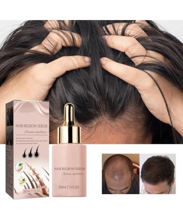 Nmbol Hair Growth Spray 1 - Buy Online on GoSupps.com