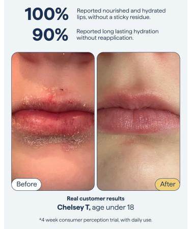 Remedy for Dry Lips | All-In-One Lip Treatment | Hydrating and Healing Lip Balm Ointment with Ceramides Peptides and Dimethicone | Repairs Dry Cracked Lips | By Dermatologist Dr. Shah - Buy Online on GoSupps.com