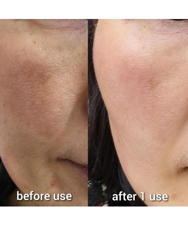 Hydrogen Dual Skin Changer Set | Hydrating Anti-Aging K-Beauty Therapy | International Shipping - Buy Online on GoSupps.com