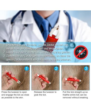 Buy Iokheira Tick Pliers for Dogs & Cats - 3 Set Tick Hooks & Tweezers for Children & Pets | Safe & Simple Tick Remover - Buy Online on GoSupps.com