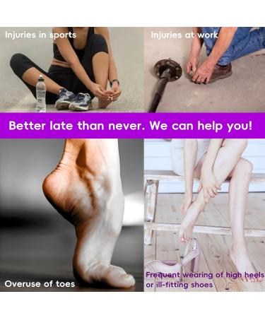 Toe Straightener - 6 Pack Gel Toe Splints for Hammer Toe Correction - Large Size White Cushions for Men & Women - Buy Online on GoSupps.com