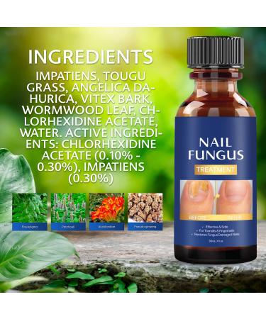 Extra Strength Toe Nail Fungus Treatment - Effective Nail Repair Solution for Healthy Nails - Buy Online on GoSupps.com