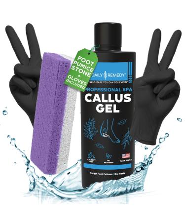 Foot Callus Remover Gel Set - Professional Callus Remover for Feet Gel - Calloused Feet Remover Gel - Feet Callus Remover for Smooth Feet & Cracked Heels - 8oz with Pumice Stone - Made in USA Callus Gel + Purple Pumice