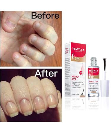 Mavala Stop Nail Polish Treatment | Bitter Taste Deterrent | Easy Application | Ages 3+ | 0.3 Fl Oz - Buy Online on GoSupps.com