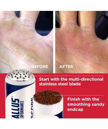 Smoothing Caps - 3 Pack | Effective Callus Remover for Superior Performance - Buy Online on GoSupps.com