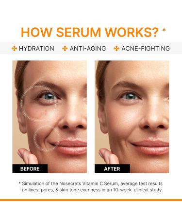 Advanced Vitamin C Serum with Hyaluronic Acid | Anti-Aging Dark Spot & Wrinkle Solution | Hydrating Face Serum with Centella Asiatica & Gotu Kola Extract - Buy Online on GoSupps.com