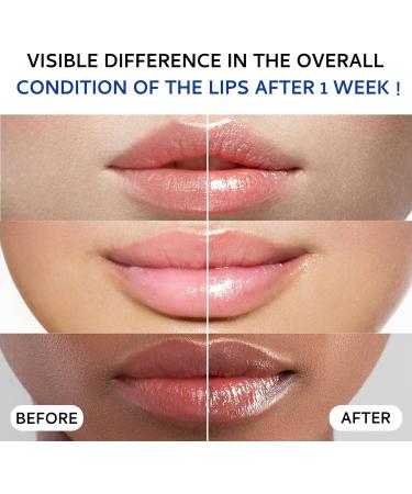 Lip Sleeping Mask(20g) Lip Collagen Lip Mask Overnight Lip Plumper Advanced with Hydridic Acids Lip Mask With Peptide Complex For Lip Wrinkles Repair Overnight Lip Masks - Buy Online on GoSupps.com