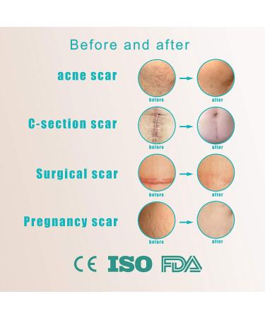 Krucasano Silicone Scar Removal Sheets - 4 Month Supply for Keloid, C-Section, Post-Surgery & Acne Scars - 1.57 x 5.9 - 8 Sheets - Buy Online on GoSupps.com