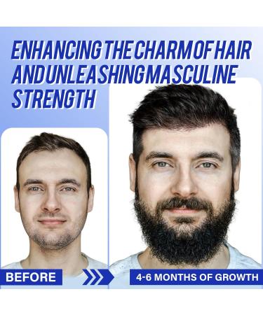 5% Minoxidil Hair Growth Serum for Men - Scalp Applicator Comb for Hair Loss & Beard Regrowth - Topical Solution to Thicken Hair - Buy Online on GoSupps.com