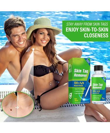 Memonotry Skin-Tag-Remover-Serum 30.00ml - Extra Strength Treatment for Skin Tags & Warts - Painless & Safe Removal - Pack of 1 - Buy Online on GoSupps.com