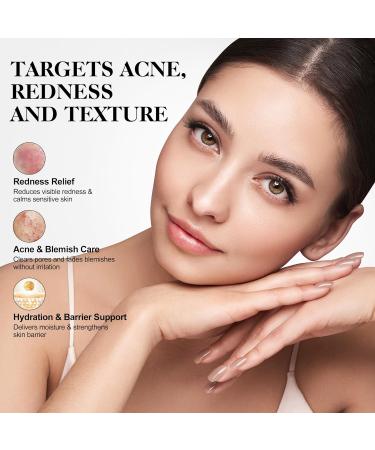 Azelaic Acid 10% for Face with 360 Roller, Centella Asiatica and Hyaluronic Acid Soothing Serum for Redness & Sensitive Skin, 0.7 fl oz - Buy Online on GoSupps.com